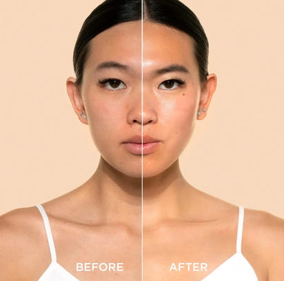 Rice Peel Shot Ampoule™