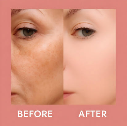 Rice Peel Shot Ampoule™