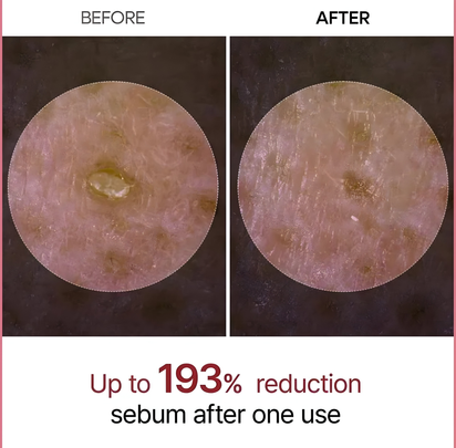 Rice Peel Shot Ampoule™