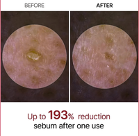 Rice Peel Shot Ampoule™